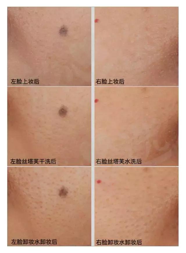 丝塔芙洗面奶敏感肌可以用吗,洗面奶丝塔芙敏感肌