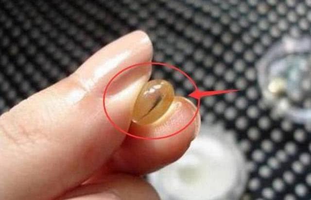 维生素e擦脸致癌吗,维生素e擦脸真的祛斑吗