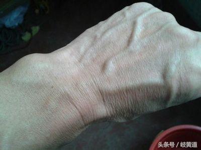 静脉血管明显好不好,静脉明显好不好