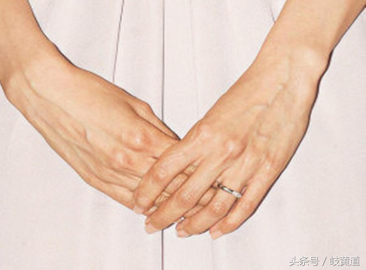 静脉血管明显好不好,静脉明显好不好