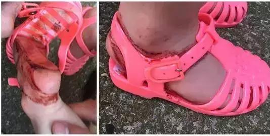 童鞋质量检测合格的品牌,童鞋质检不过关品牌编码