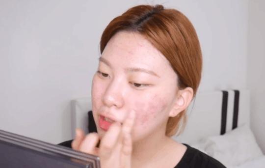 下巴明显红色痘印怎么遮瑕,高遮瑕底妆遮痘印