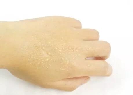 夏天保湿喷雾水小瓶,十大公认好用的保湿喷雾