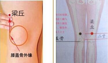 中医穴位埋线减肥疗法,中医减肥针灸穴位