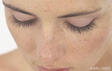 中草药美白祛斑防晒霜,防晒霜祛斑方法