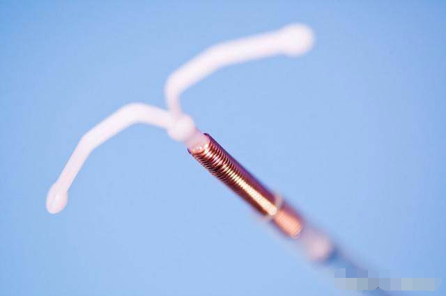 取环后多久可以备孕二胎,二胎取环多久可以再备孕