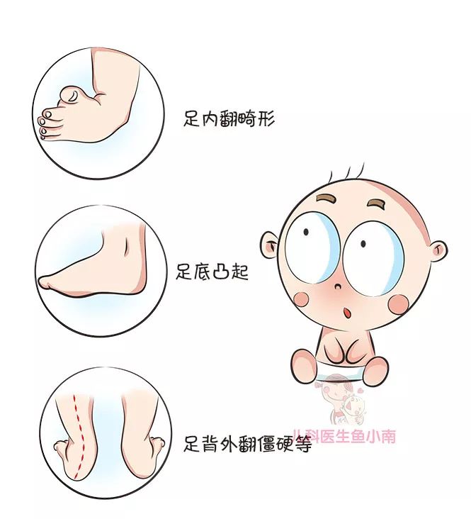 鞋子选不好会影响孩子发育吗,什么鞋子对孩子脚发育好