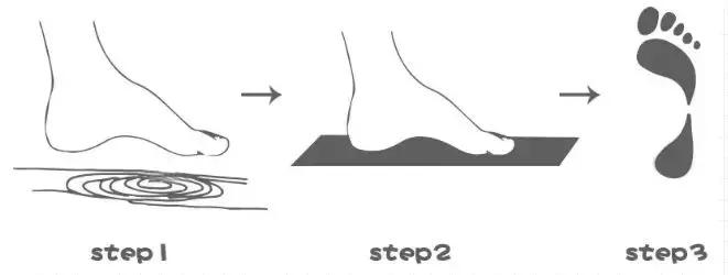 畸形脚型,看脚型分辨你适合穿怎样的鞋子
