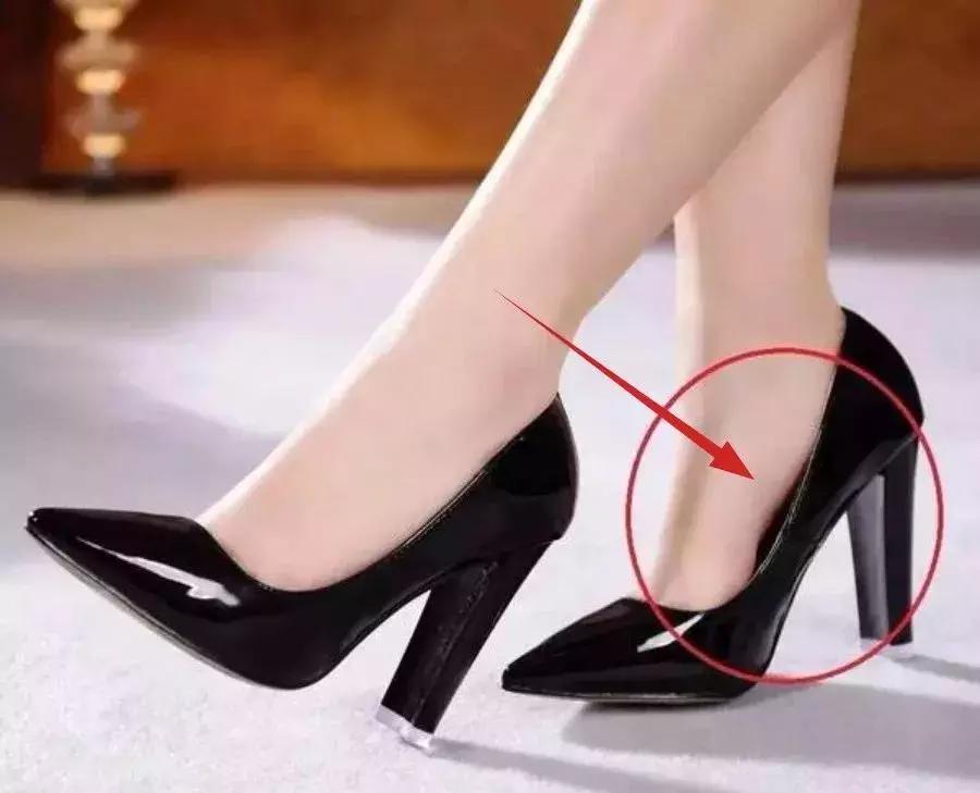 畸形脚型,看脚型分辨你适合穿怎样的鞋子