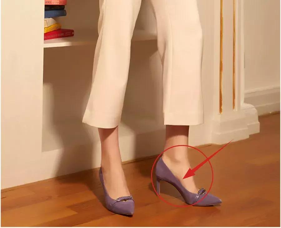 畸形脚型,看脚型分辨你适合穿怎样的鞋子