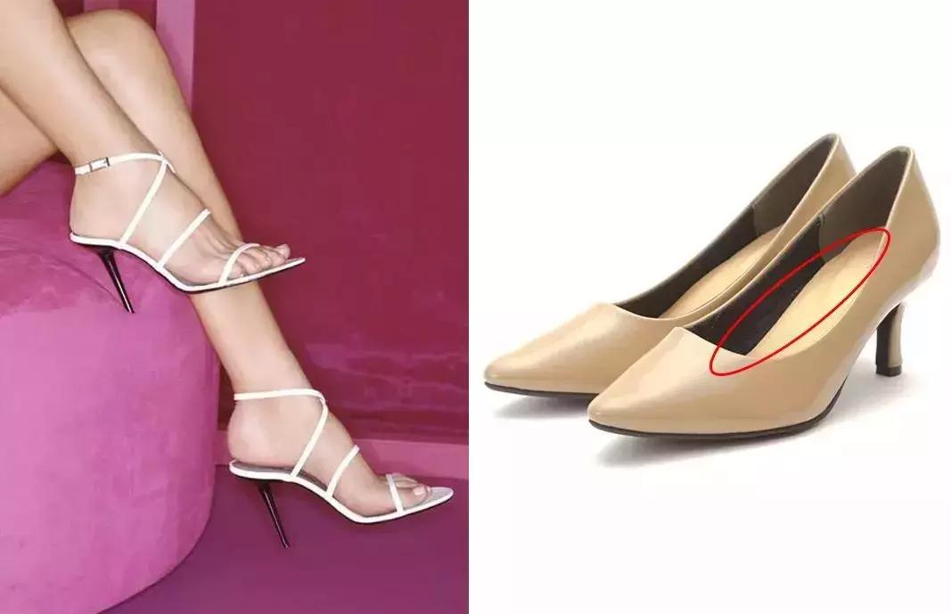 畸形脚型,看脚型分辨你适合穿怎样的鞋子