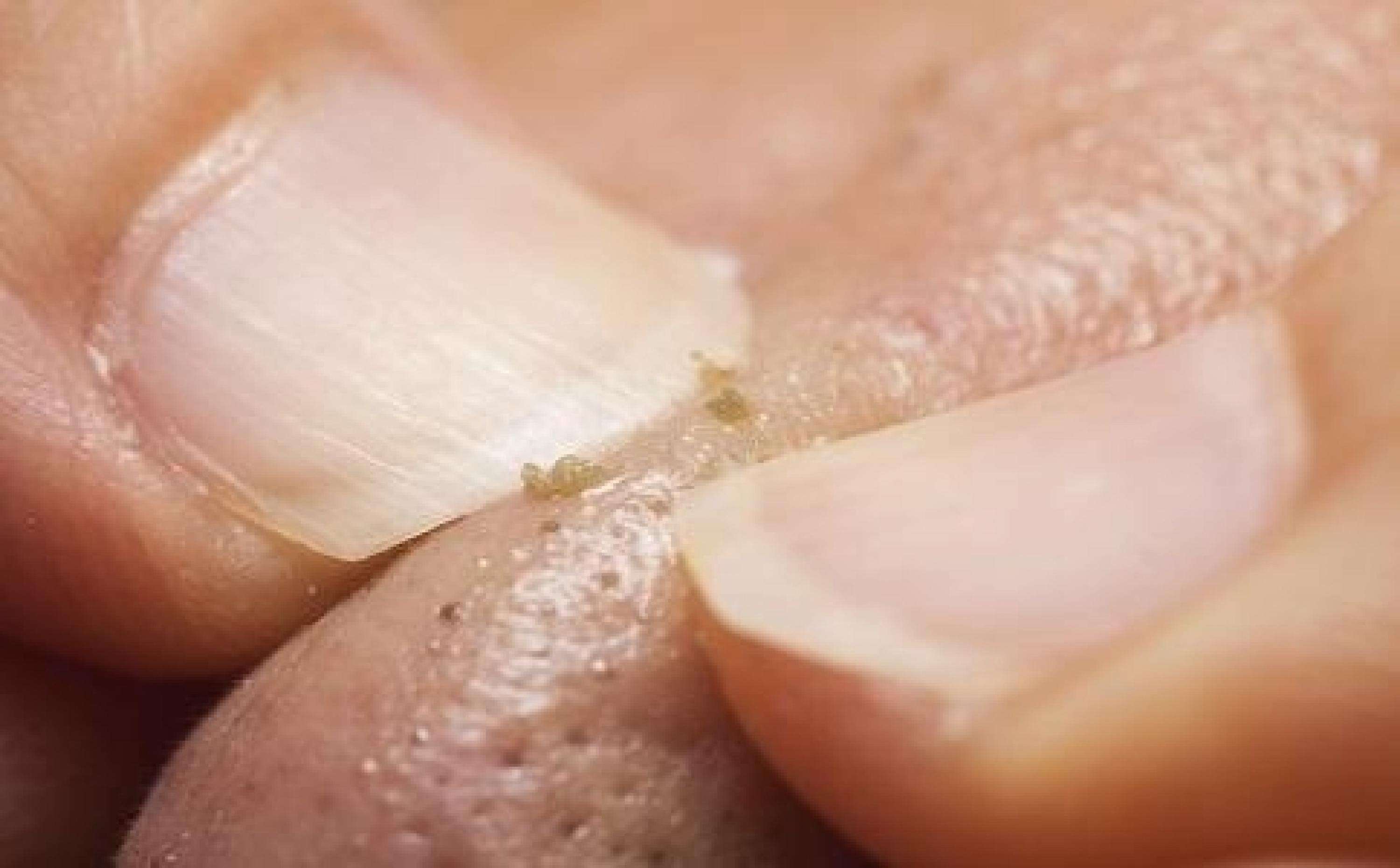 这可能是最有效的去黑头方法！只有深刻认识草莓鼻，才能搞定它！