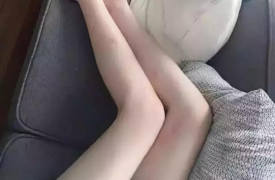 蚊虫叮咬止痒消肿驱蚊膏,止痒膏驱蚊止痒