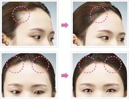 杨幂的刘海发际线,杨幂隐藏发际线的刘海