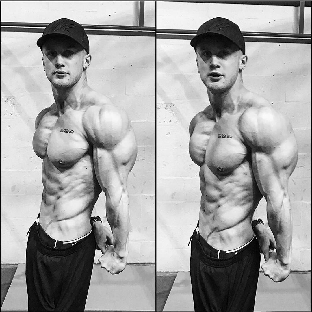 肩膀都过度内旋了,这是怎么造成的呢?别纠结了,赶紧矫正