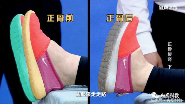 中医正骨治疗腰疼视频,腰疼最快缓解方法躺床上正骨