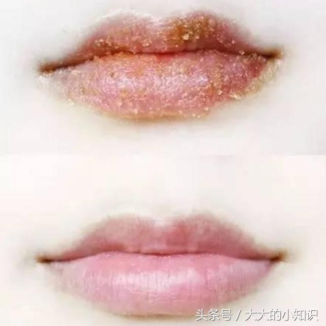 去脸上死皮角质的原理,怎样排老化的细胞角质