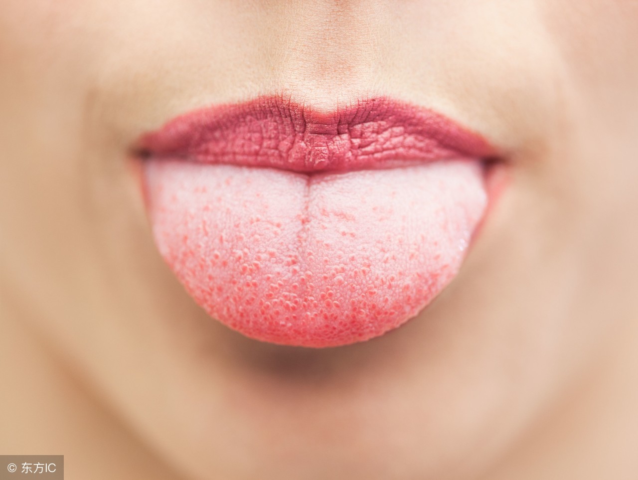 舌头反映身体的信号,舌头一旦出现这个信号马上去医院