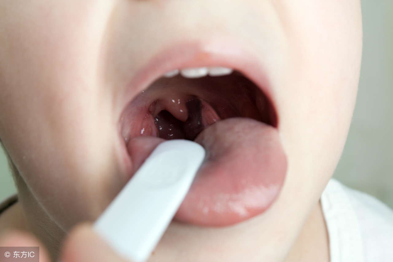 舌头反映身体的信号,舌头一旦出现这个信号马上去医院