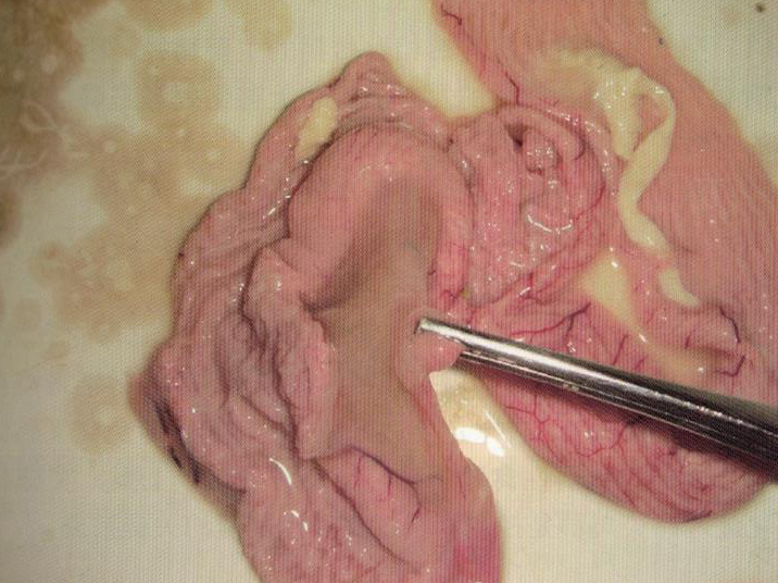 鹌鹑禽流感解剖图,鸡患禽流感症状及图片