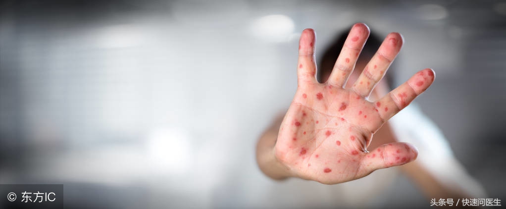 血常规查出有梅毒,血常规检查的梅毒偏高怎么回事