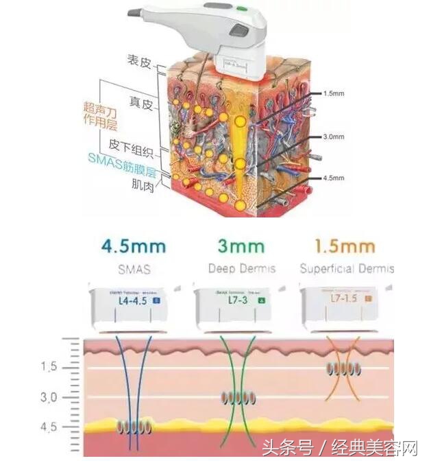 张雨绮吐槽超声刀,超声刀张雨绮