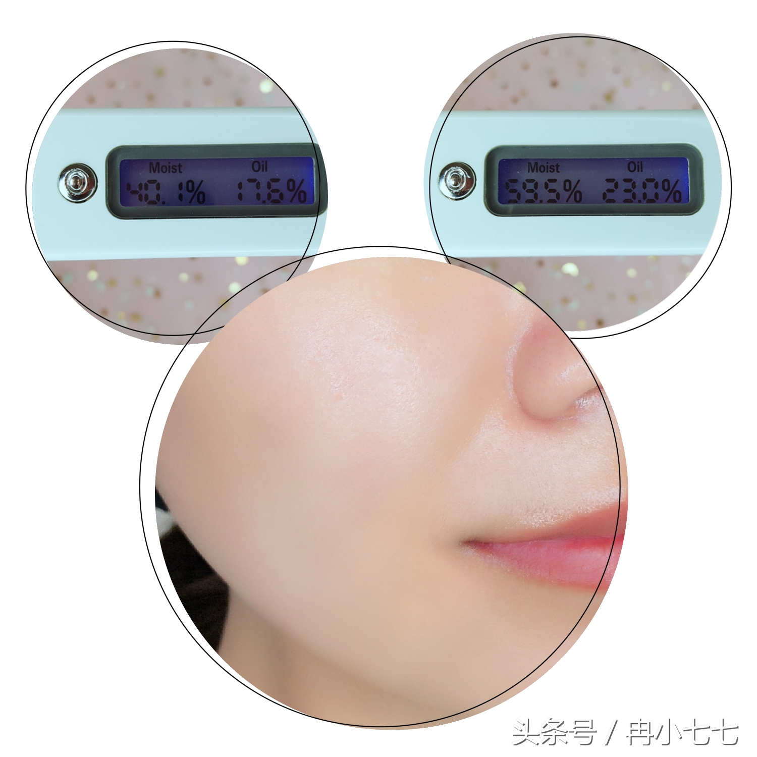 夏天油皮亲妈护肤品,夏季油皮亲妈