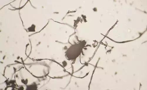 因为喜欢吃这东西,孩子患肠螨病,虫子进入尿道、肺部……