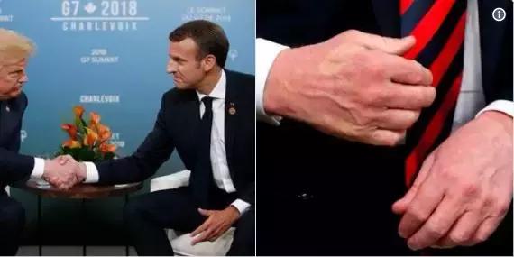 特朗普被“握手杀”;林俊杰演唱会裤子掉了,NARS请*毒涉**艺人站台