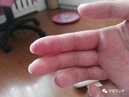 被仓鼠咬伤后怎么处理伤口,被仓鼠咬伤的伤口如何处理