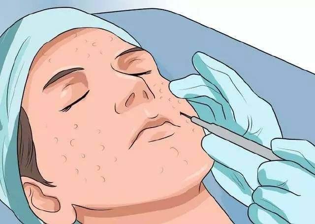 让毛孔变小用什么药,30几岁的皮肤毛孔粗能变小吗