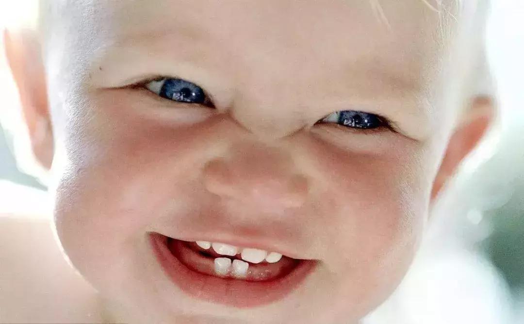 孩子口腔系带有什么危害,儿童上唇系带连接牙龈有什么影响