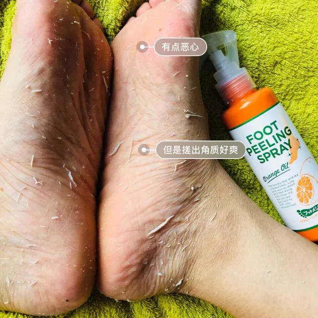 精致鞋护理,护理去死皮