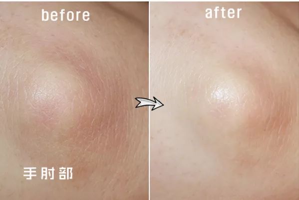 精致鞋护理,护理去死皮