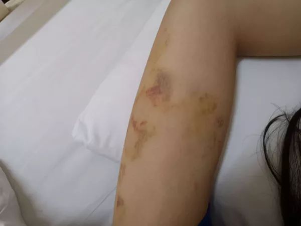 莆田系医院出医疗事故怎么办,莆田一医院打人事件