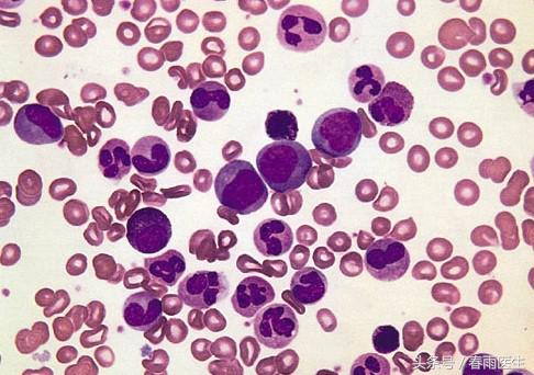 我不是药神最终挣多少钱,我不是药神30000块钱的药吃了三年