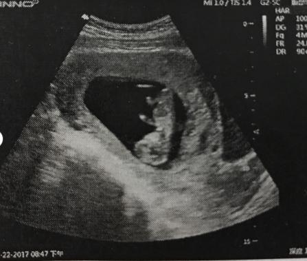 孕期知识准爸爸准妈妈备孕,我的孕期记录