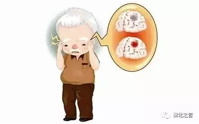 健康科普三分钟了解心梗,健康科普之脑中风