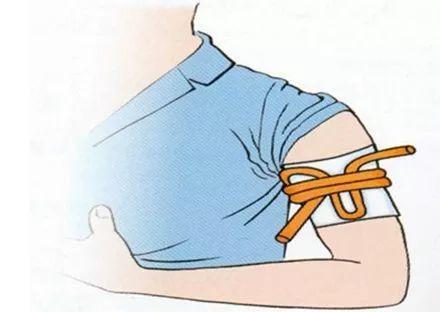 手指割破了能用嘴吗,手指被割了一个口子会愈合吗