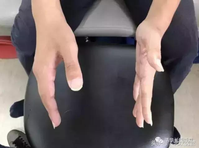 世界杯球员受伤,世界杯运动员损伤情况