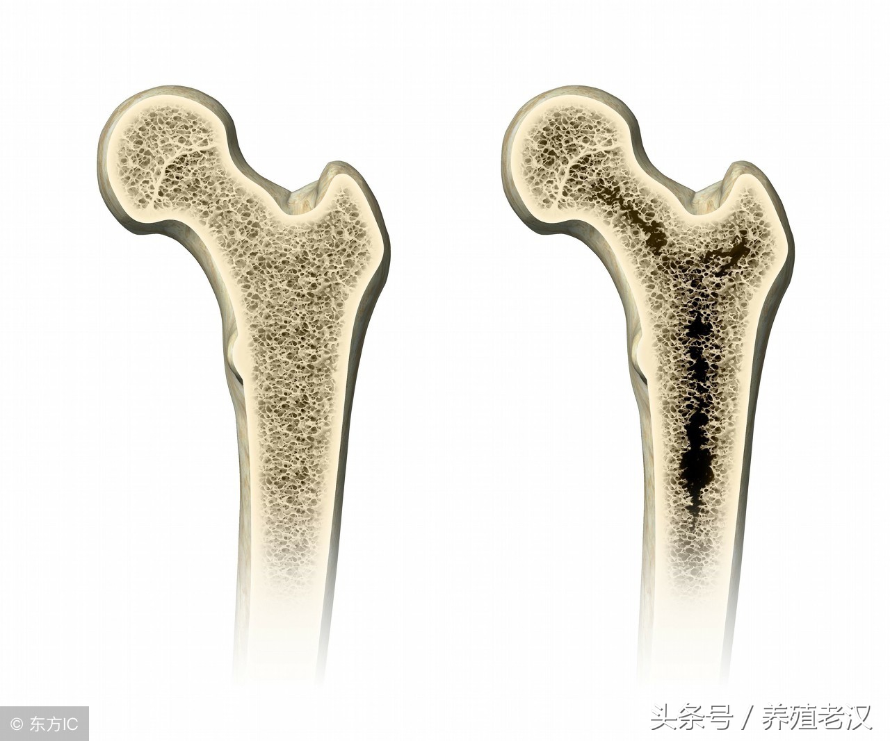 养殖户最怕的事:母猪产后瘫痪,病因和治疗方案都有了!