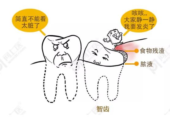 智齿痛得特别厉害怎么办,智齿痛得厉害怎么缓解