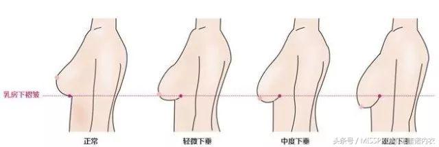 文胸穿有钢圈好还是无钢圈好,有钢圈和无钢圈的文胸