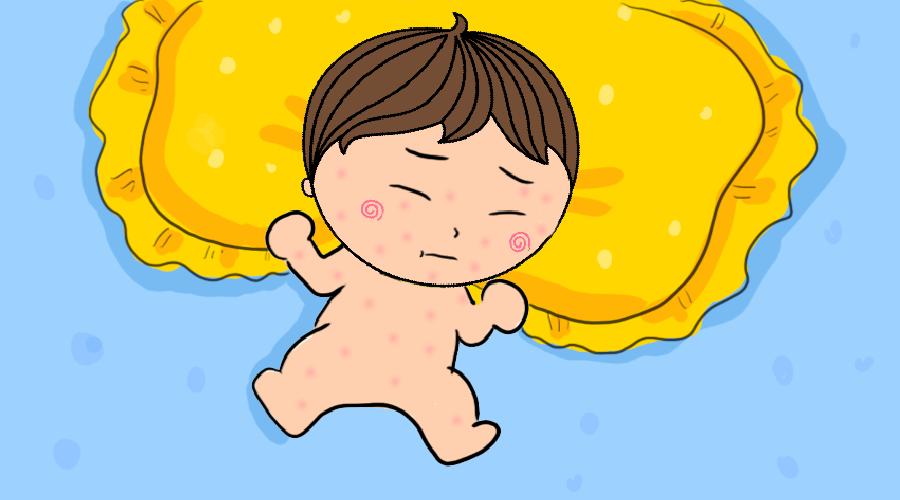 新生儿热疹和湿疹的预防与护理,宝宝耳朵上的湿疹怎么预防它复发