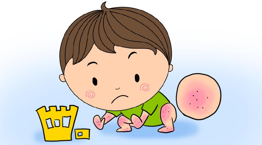 新生儿热疹和湿疹的预防与护理,宝宝耳朵上的湿疹怎么预防它复发