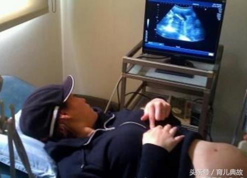 胎监要注意事项,胎监需要注意什么