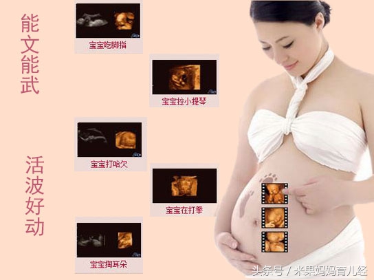 怀孕期做个四维彩超一般多少费用,怀孕几个月做四维大概多少钱