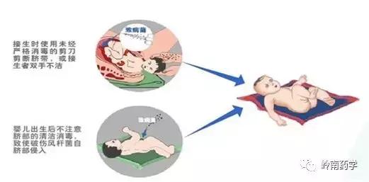 除了打破伤风针有什么药可以预防,在伤口处贴创可贴能预防破伤风吗