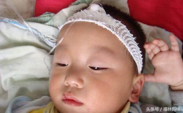 抗生素滥用的危害有哪些,滥用抗生素的危害有哪些