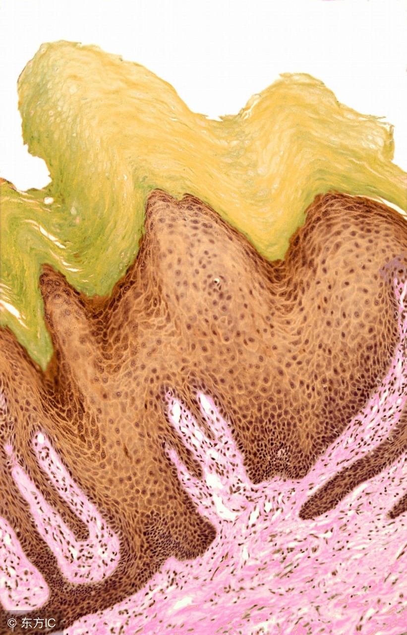 生活小妙招去除寻常疣,怎么预防寻常疣最有效方法